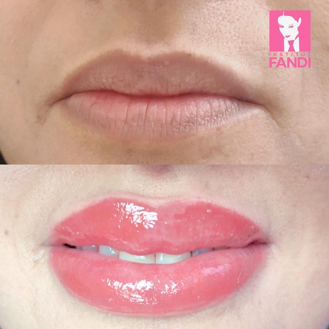 Microblading & brow restoration