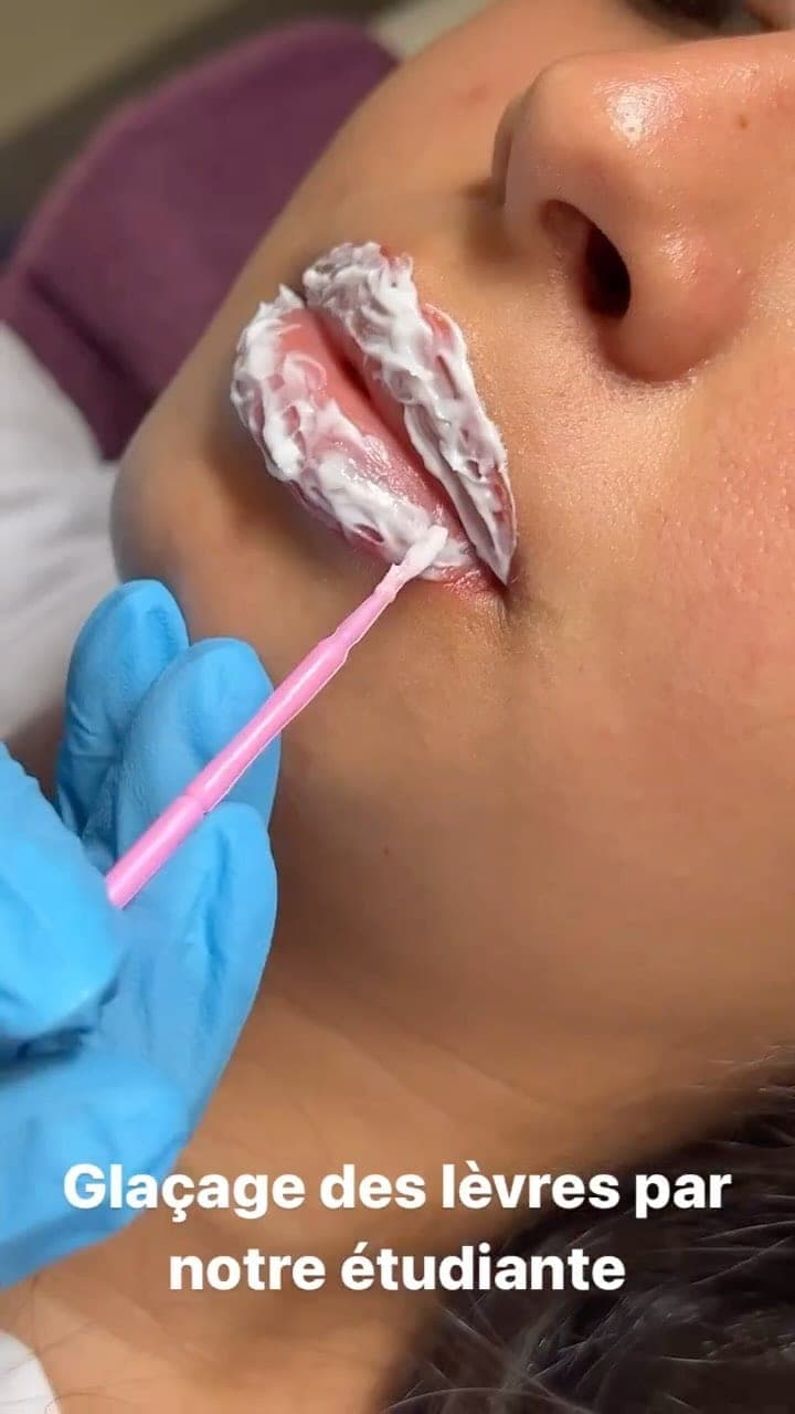Professional facial